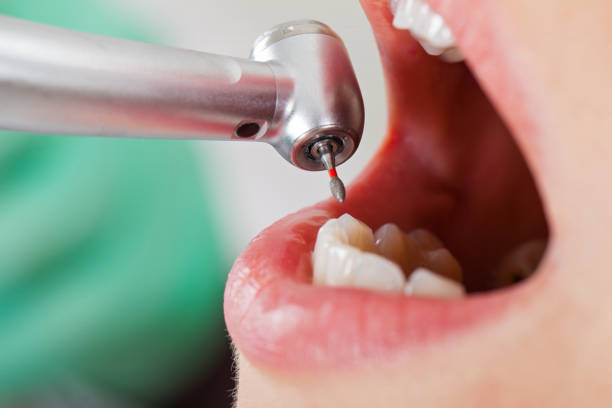 Best Emergency Dentist for Knocked-Out Tooth in Pulaski, TN